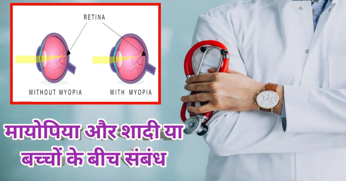 Link between Eye Problem and Marriage, मायोपिया और शादी या बच्चों के बीच संबंध